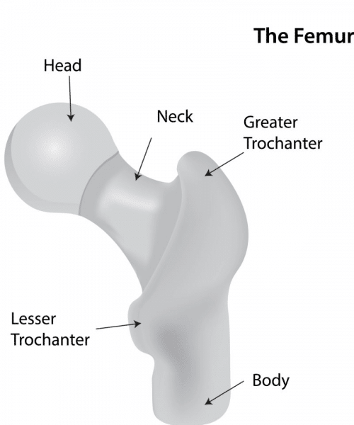 3D-rendered hip bone with sections labeled